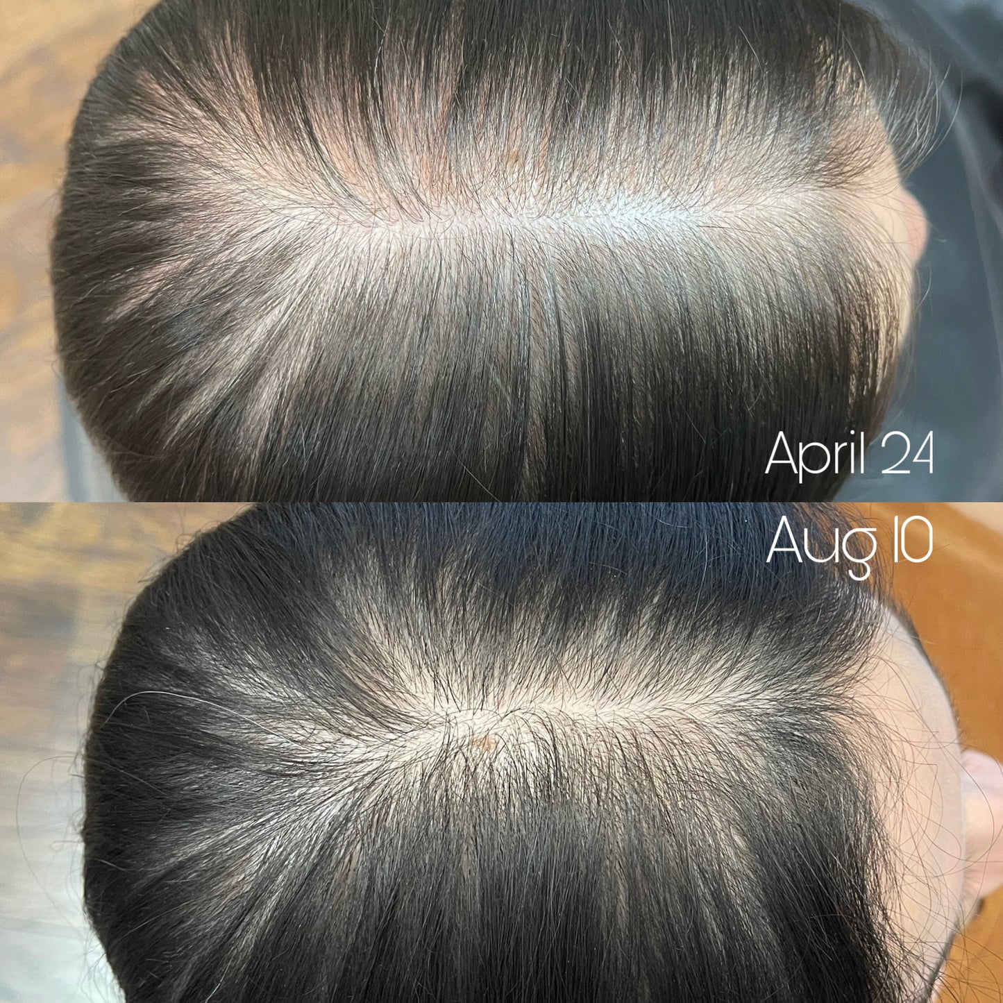 Surface Awaken Advanced Treatment System